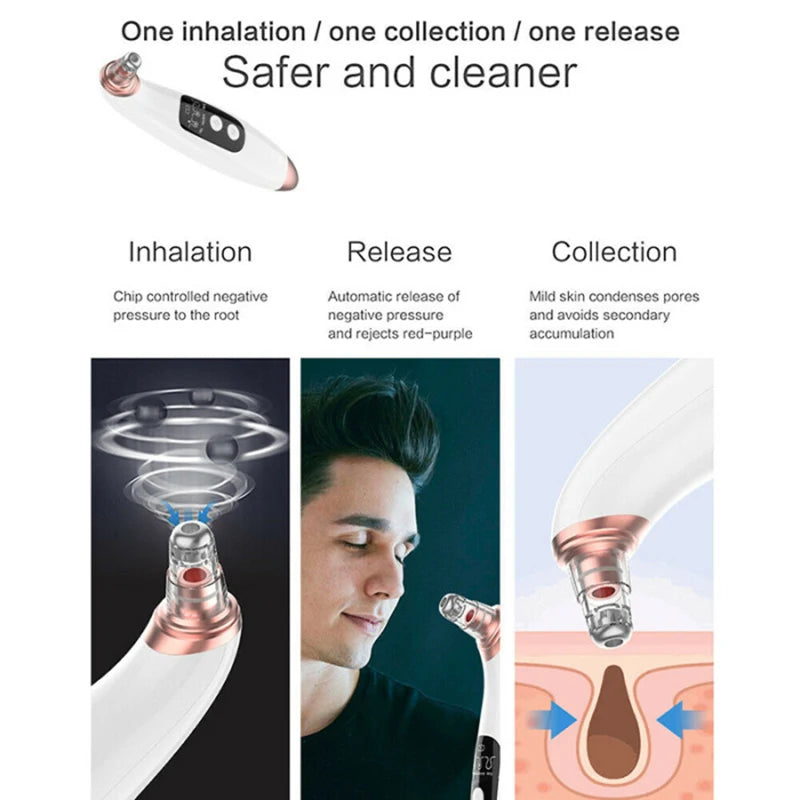 Aparat pentru puncte negre - Vacuum Pro